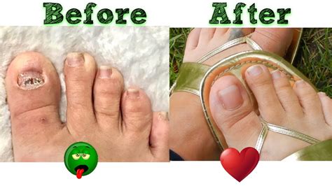 Ugly Feet Pics Can Sell Too: Discover How To Profit。